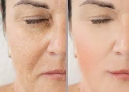 Anti Ageing Daily Care