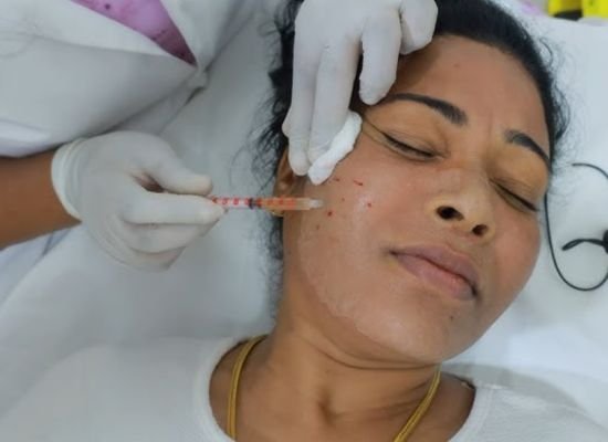 PRP Therapy Preparation