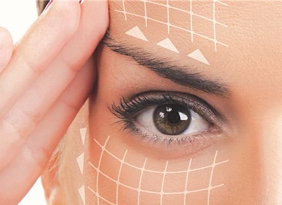 Thread Lift Treatment