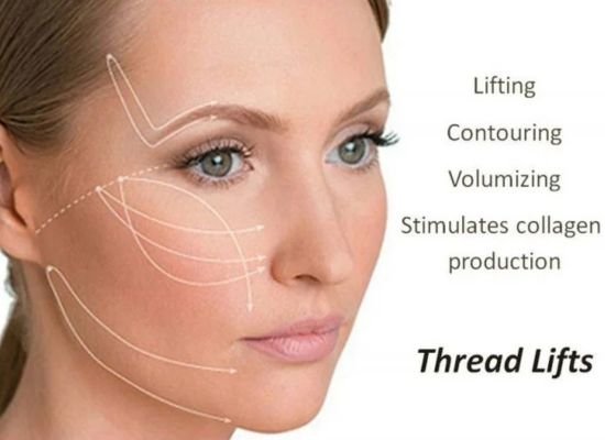 Non-Surgical Thread Lift