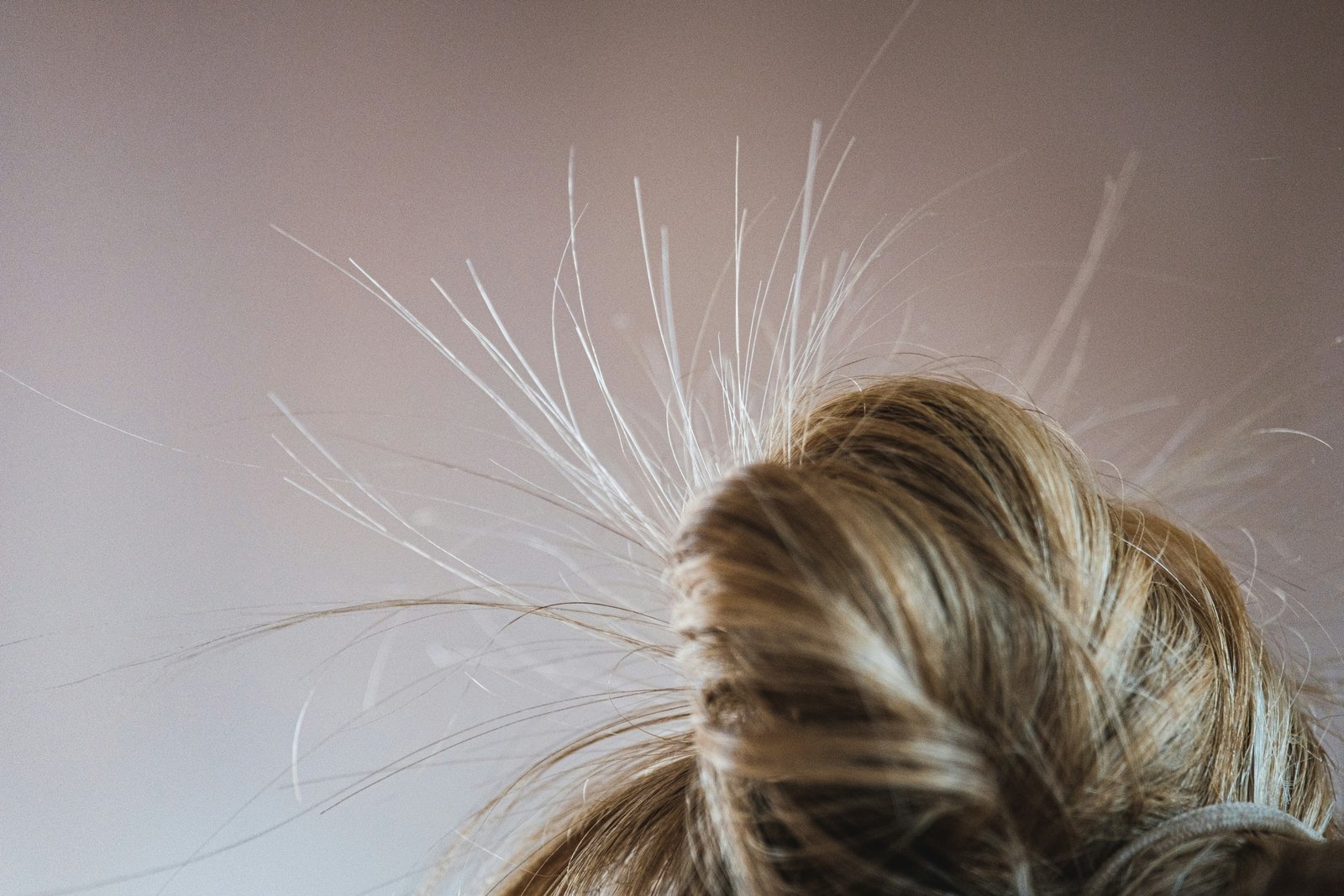 Alopecia Treatment