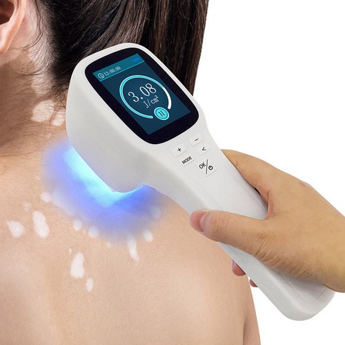 Dandruff Treatment