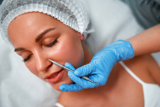 Dandruff Treatment