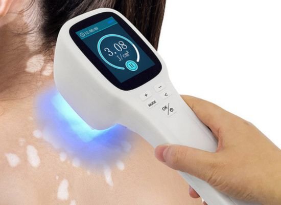 Alopecia Treatment